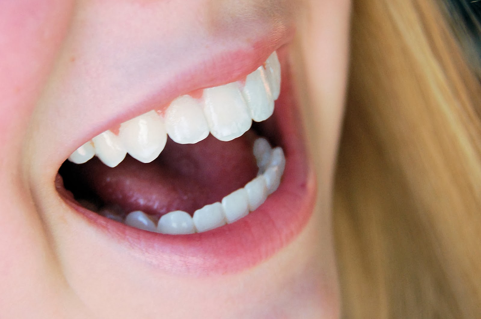 Dentes sem cárie com alimentos que melhoram a saúde da boca, combatem bactérias, a placa e limpam os dentes...