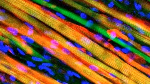 Revolucionária técnica científica cria músculos artificiais que se regeneram sozinhos como os naturais...