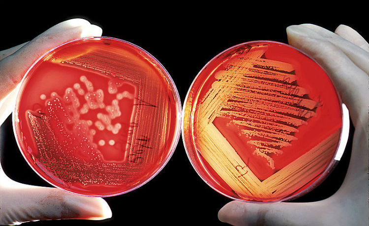 resistencia bacteriana